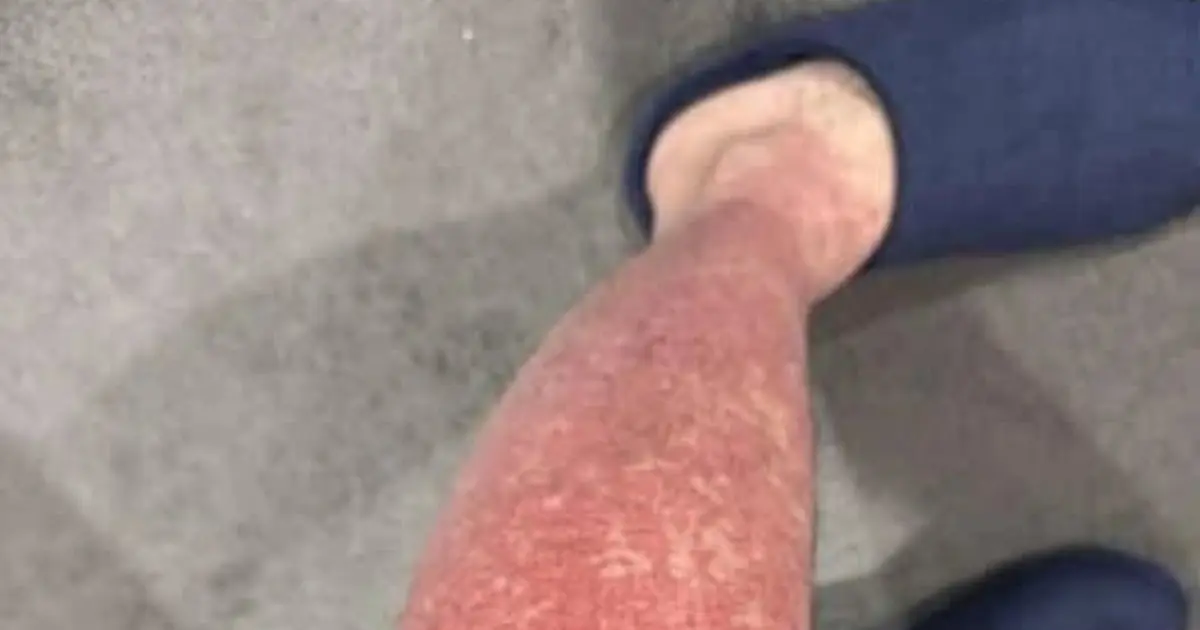 Here are the consequences of sleeping with… See more