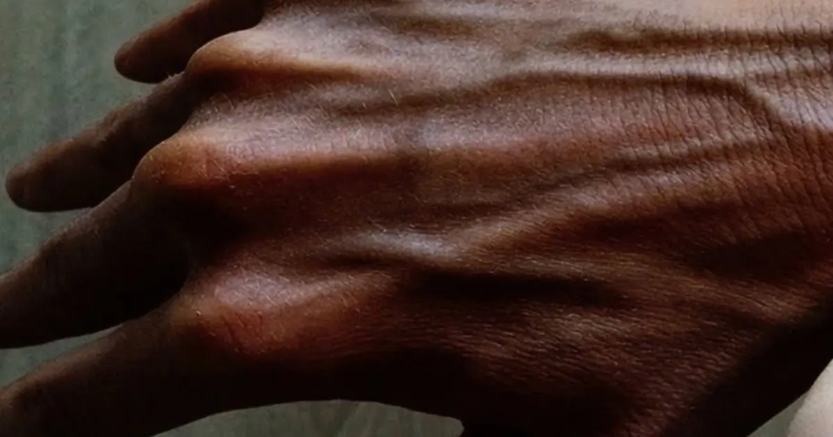 Cancer Warning Signs: 9 Areas Where Itching Could Mean Something Serious