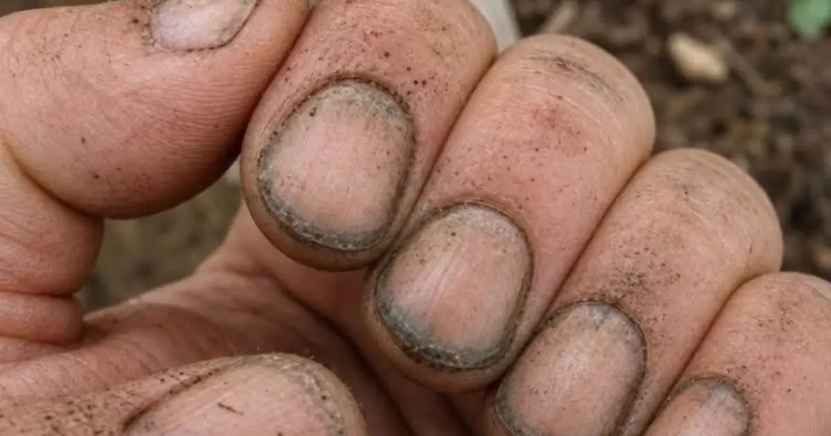 What Do Dirty or Darkened Fingernails Really Say About a Person?