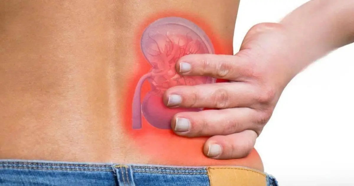 4 Drinks That May Help Support Kidney Health and Reduce the Risk of Kidney Stones