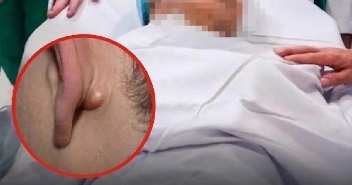 Young Man Dies After Ignoring Two Nighttime Symptoms: A Reminder About Early Cancer Warning Signs