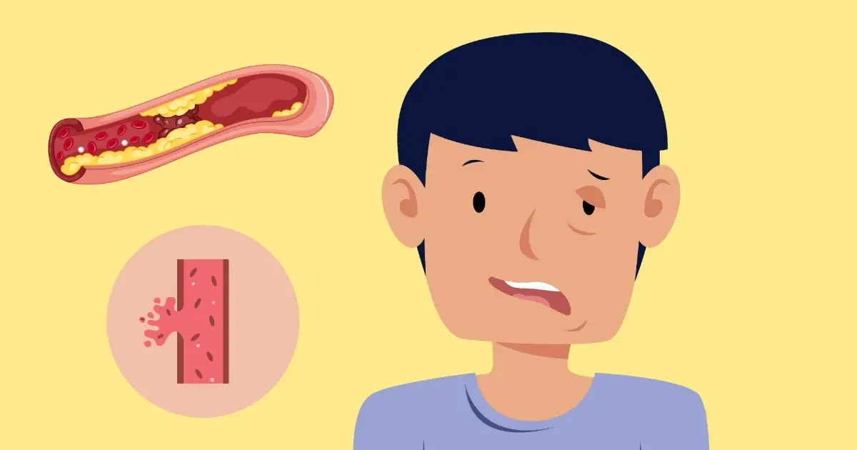 Your Body May Show These Stroke Warning Signs - Here’s What You Need to Know