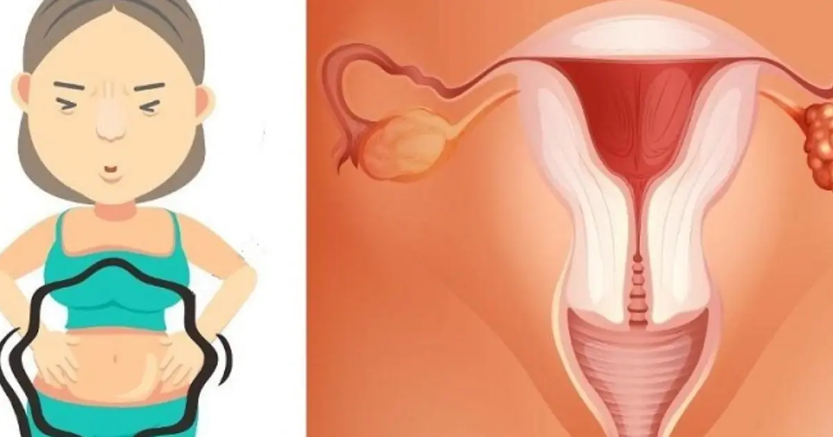 Ovarian Can.cer Can Be Hard to Spot: 8 Warning Signs You Should Know