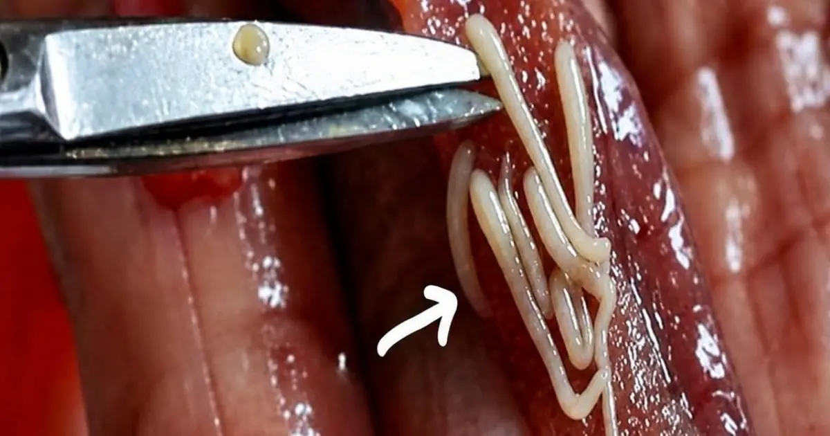 5 popular and delicious foods loved by many but also favorites of parasites