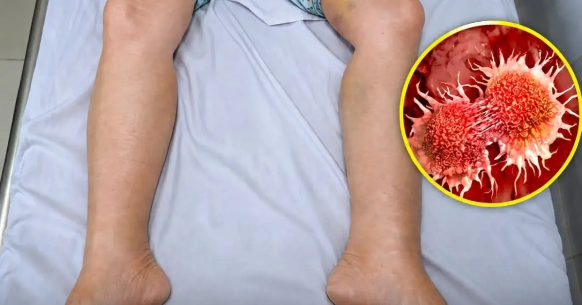 One Tiny Symptom Changed Everything... And She Almost Ignored It