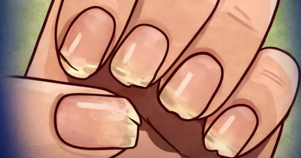 What Your Nails Might Be Telling You About Your Health: 9 Important Signs 😲
