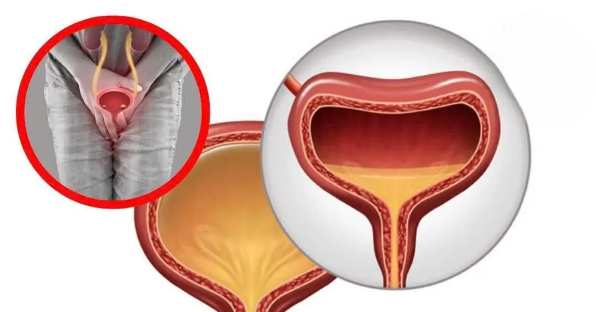 These Early Warning Signs of Bladder Cancer Often Go Unnoticed