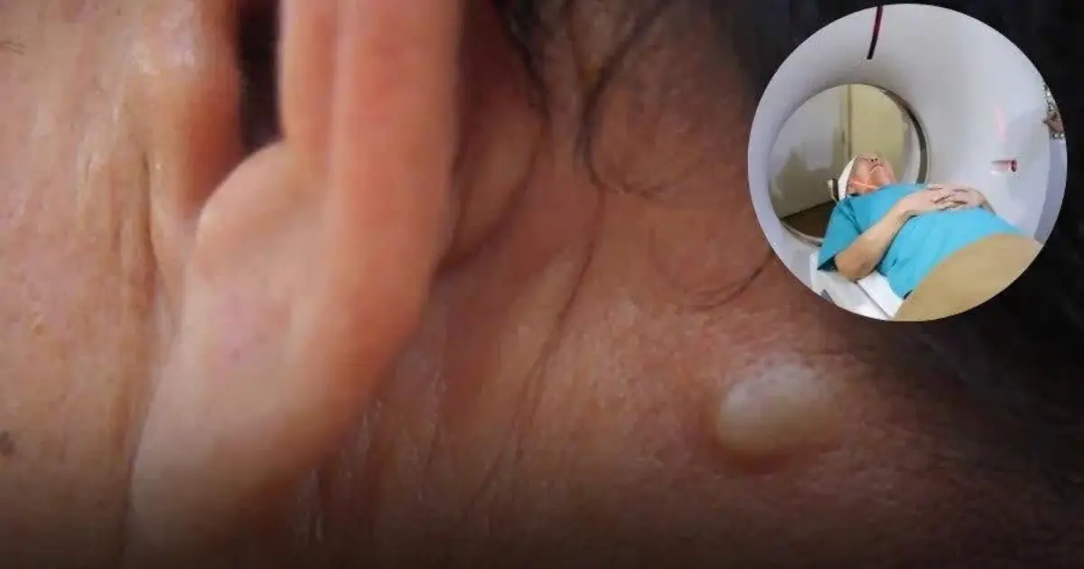 5 Warning Signs of Thyroid Can.cer You Shouldn't Ignore
