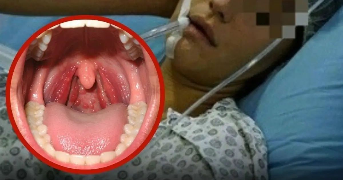 Sore Throat Turned Serious: Five Warning Signs You Should Never Ignore