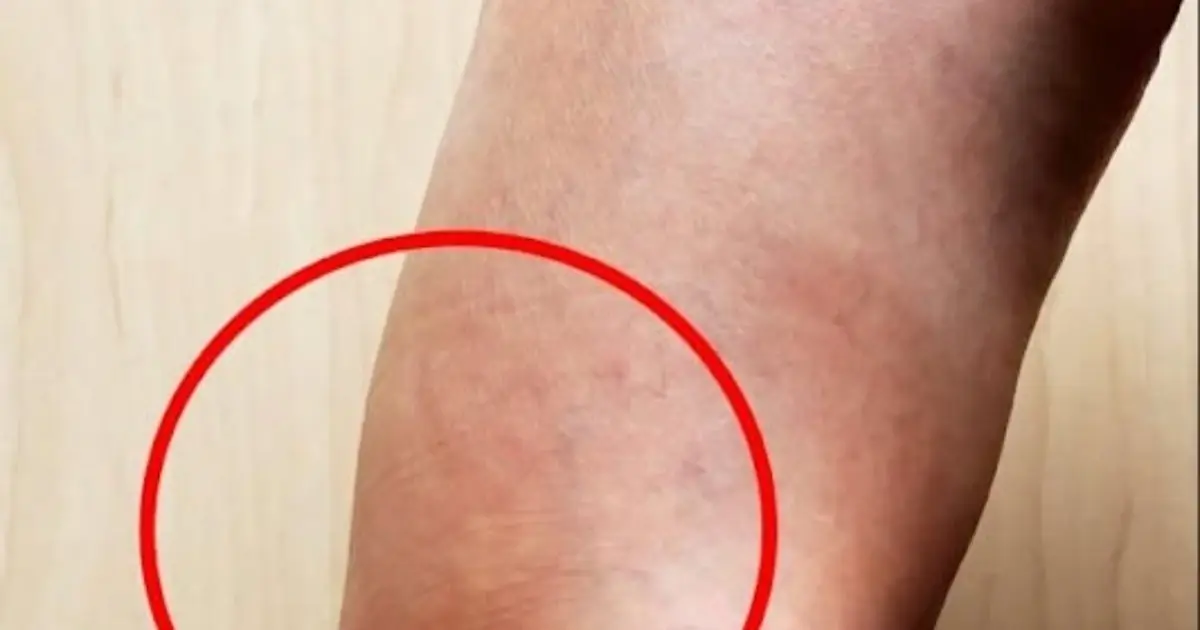 These are the consequences of sleeping with…