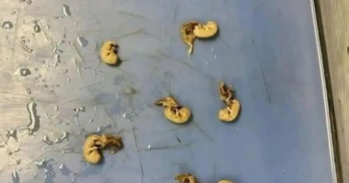 Beware the “Seeds in Your Snack”: How Hidden Threats Can Lurk in Everyday Foods