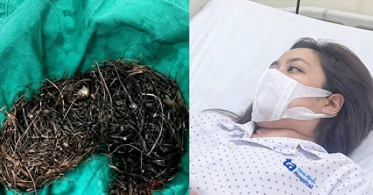 A 14-Year-Old Girl Complained of Stomach Pain for Six Months — Her Mother Was Shocked to.