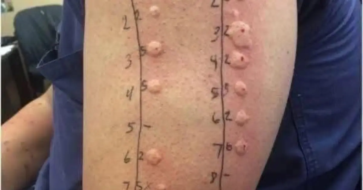 These are the consequences of sleeping with the… See more