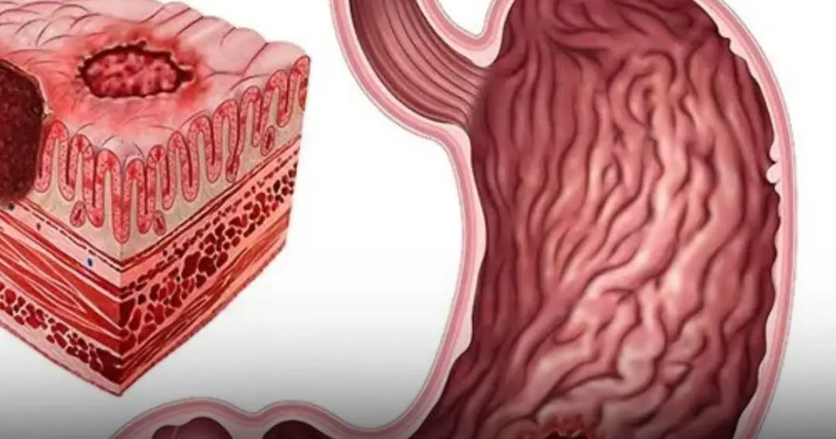 These 2 Hidden “Culprits” in Your Fridge May Be Worse for Your Stomach Than You Think