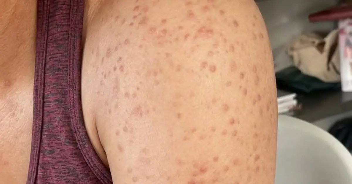 These are the consequences of sleeping with... See more