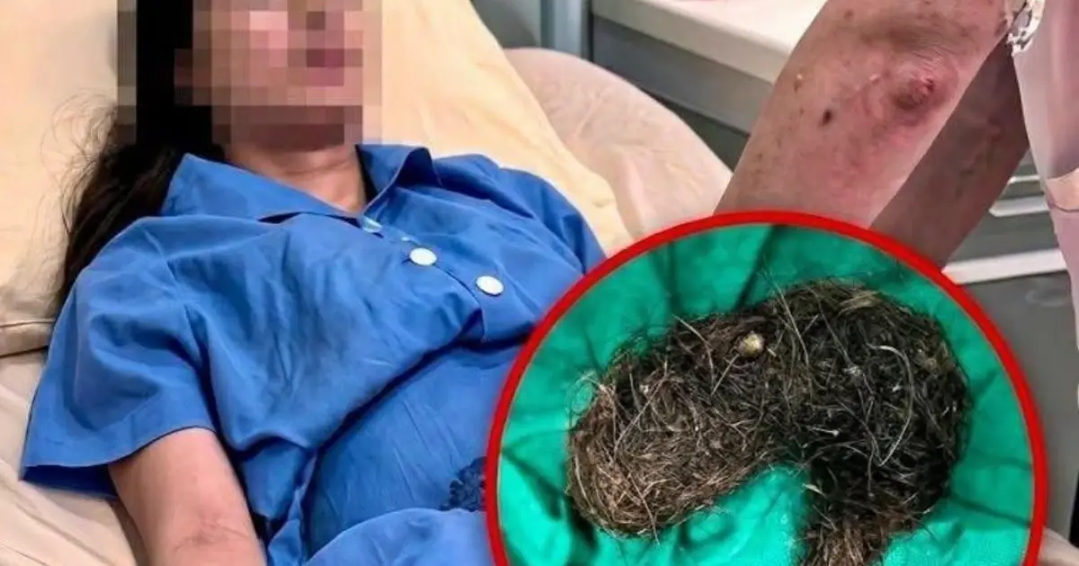 A 14-Year-Old Girl Complained of Stomach Pain for Six Months — Her Mother Was Shocked to See