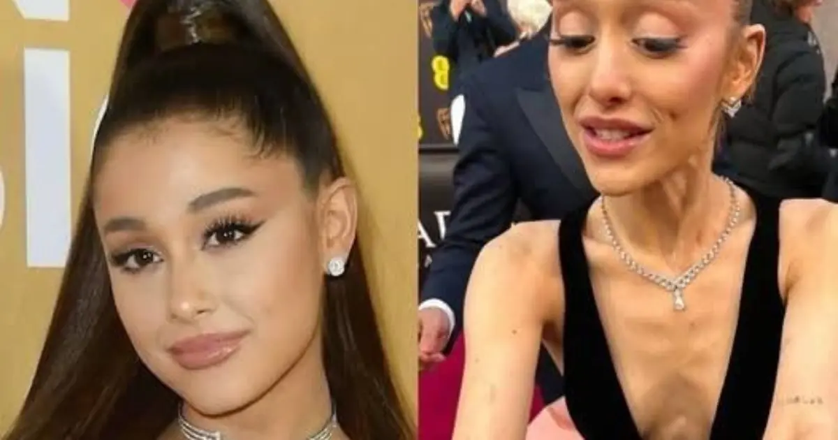 Breaking- Ariana Grande Confirms She Has Tested Positive for…See more