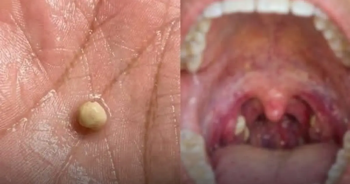 Suddenly Felt Like Something Was Stuck in My Throat… Swallowing Didn’t Help