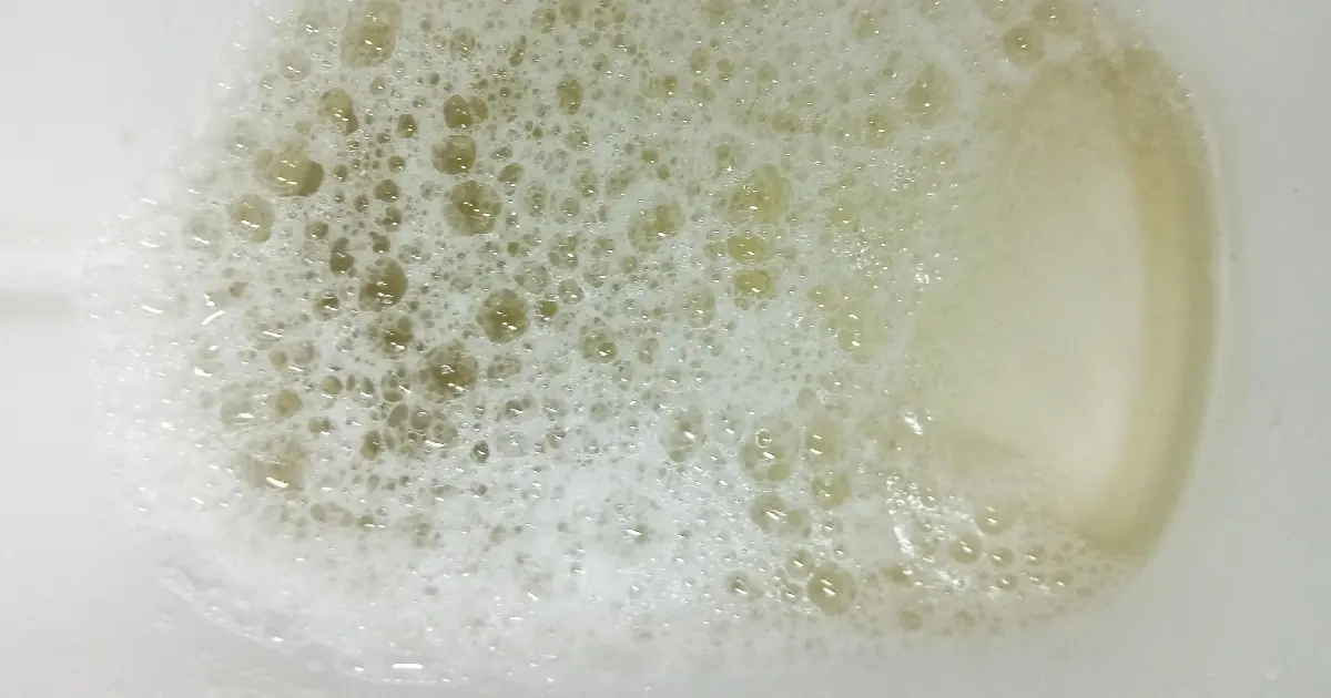 Bubbles in Your Urine: What Your Body Might Be Telling You