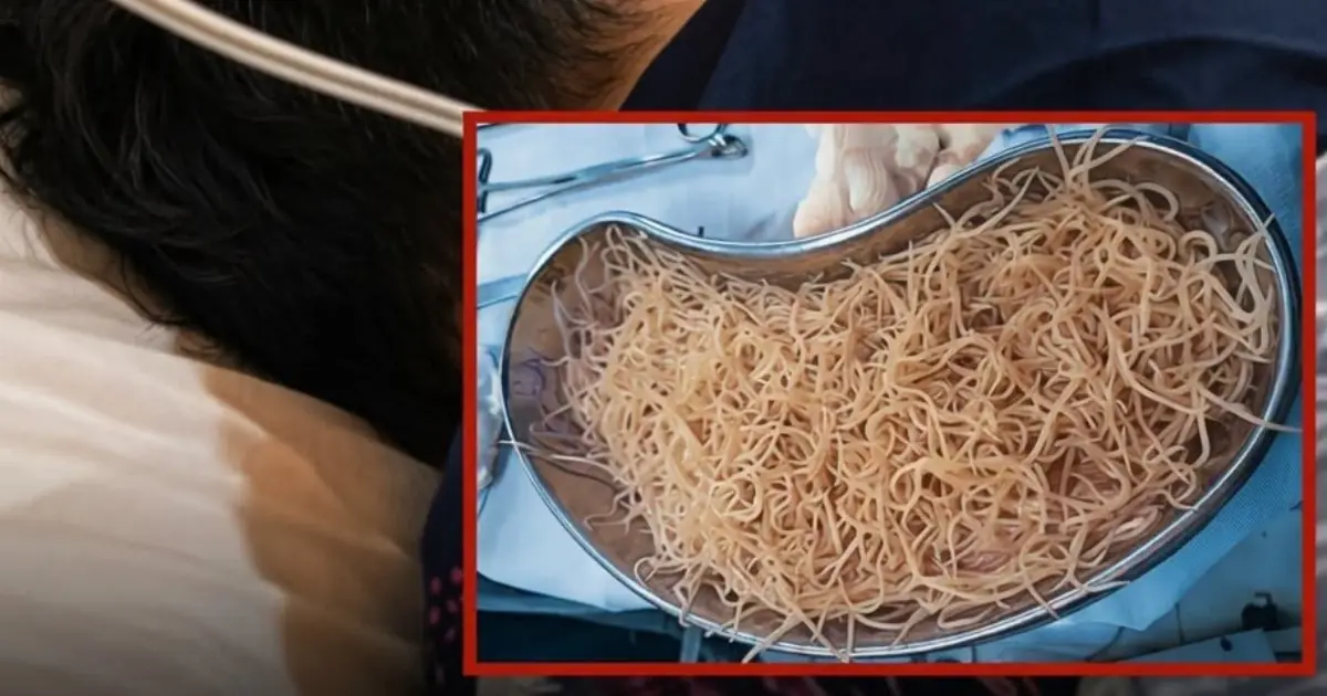 Doctors Were Sho.cked By What They Found Inside His Intestines…