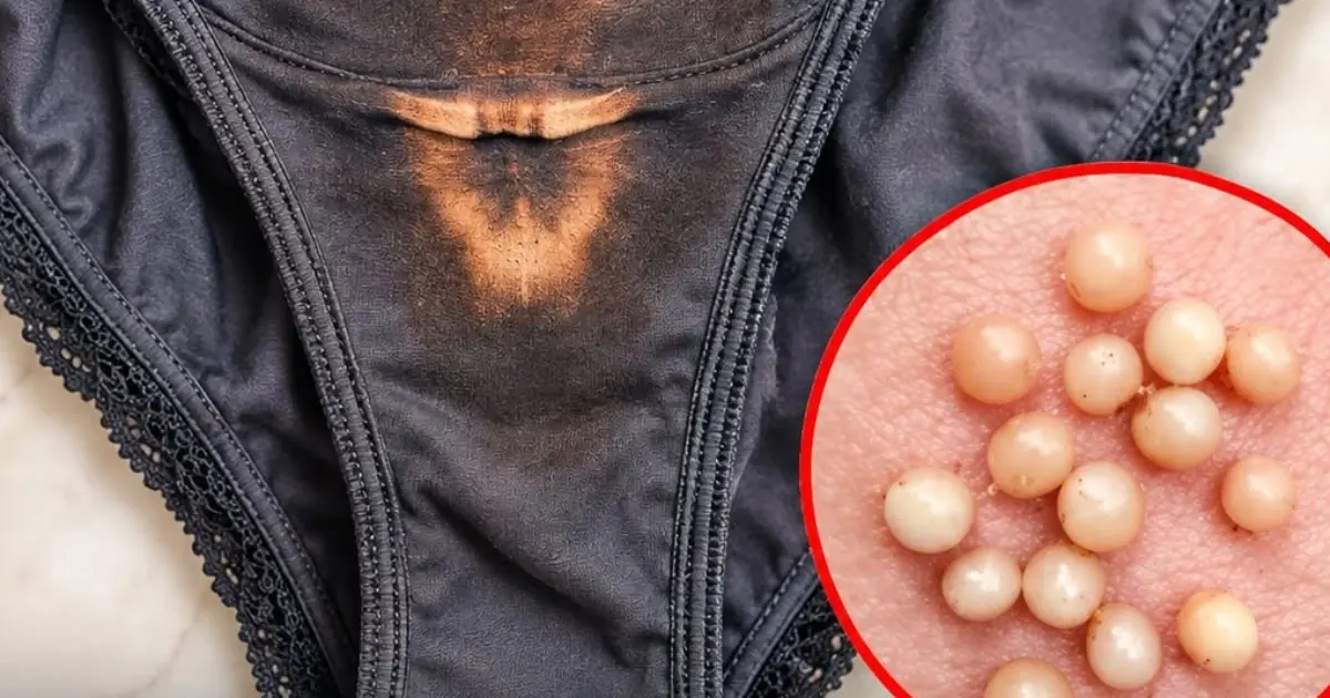 Unusual Stains on Underwear: What They May Mean and When to See a Doctor