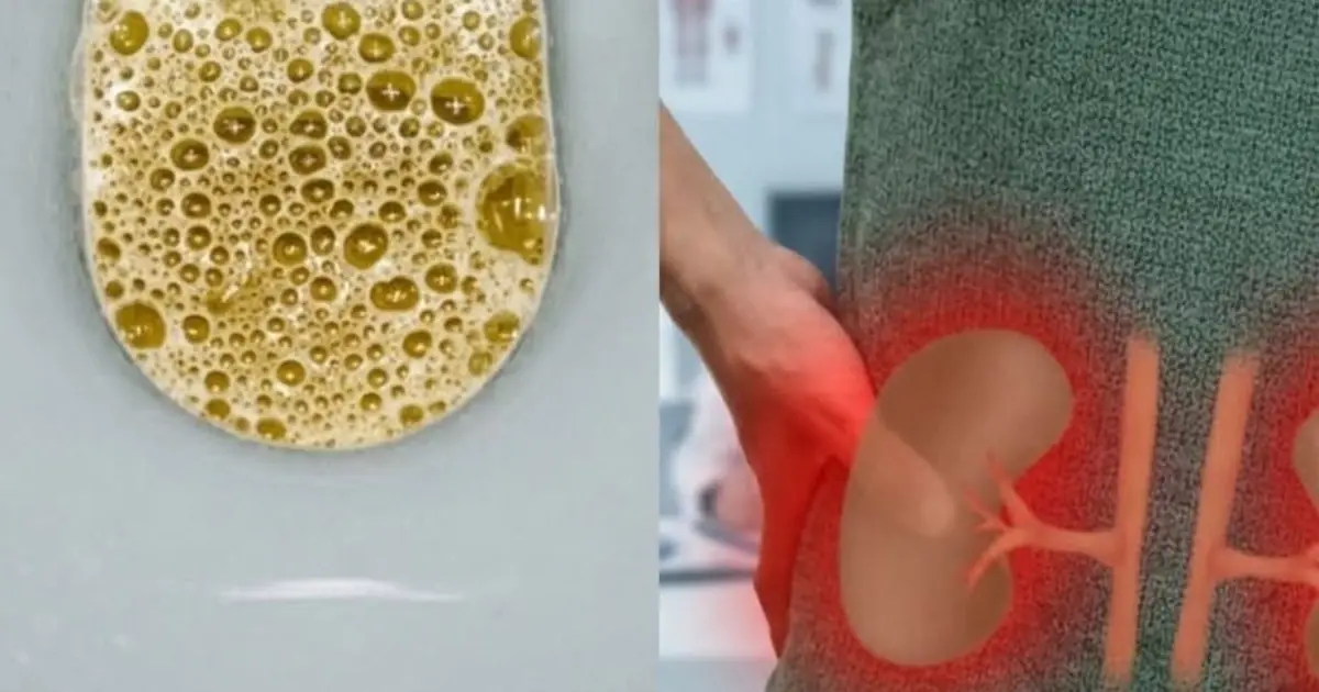 Foamy Urine Isn’t Always Random — Here’s What Could Be Causing It…