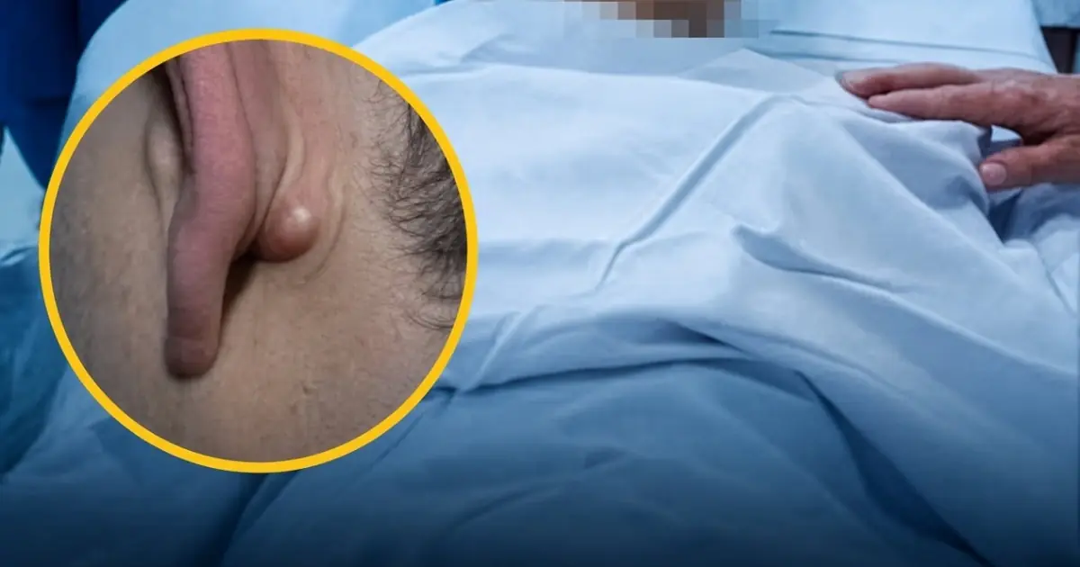 Young Man in His 20s D.i.es of C.anc.er After Ignoring Two Nighttime Symptoms