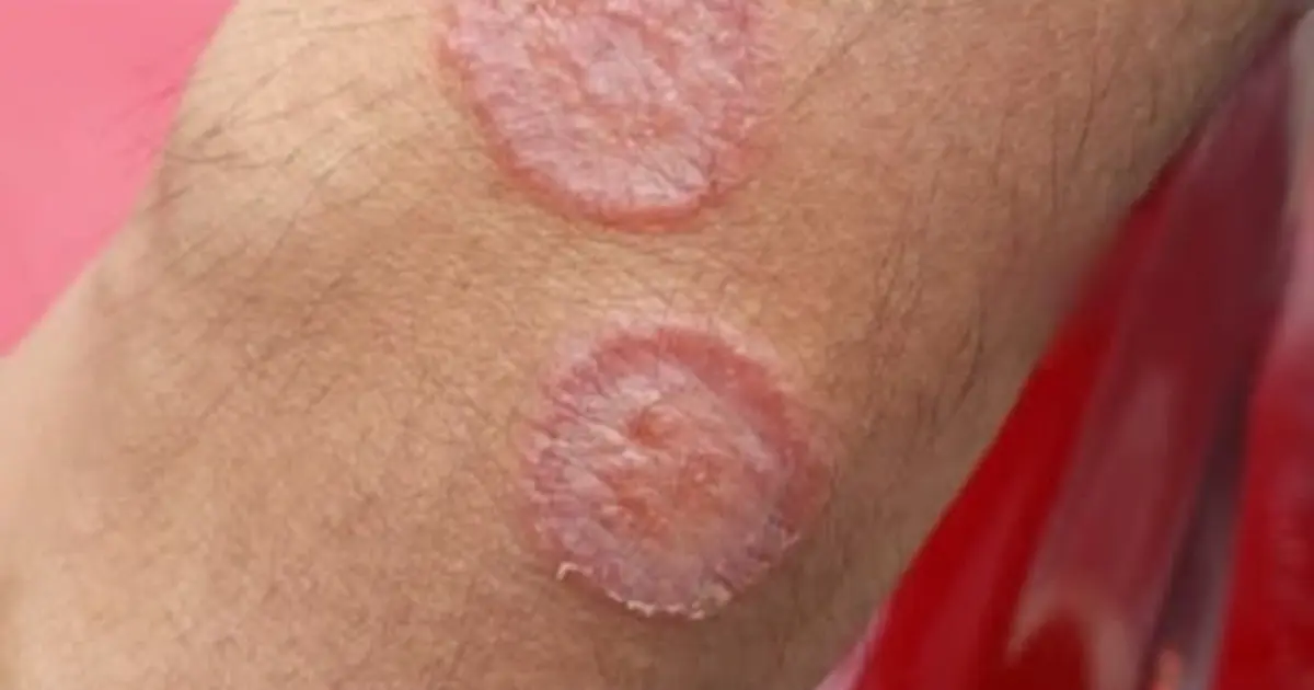 These are the signs that he is cr... See more
