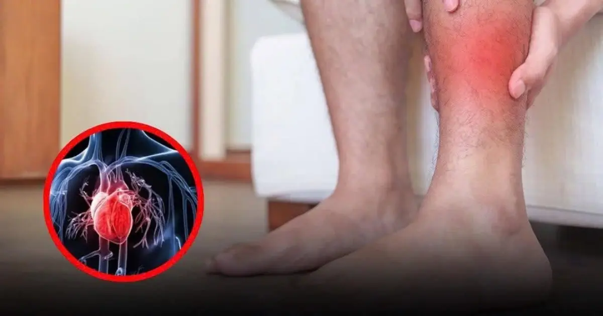 Your body may alert you to an upcoming heart attack with 5 key symptoms — often appearing 3 months early
