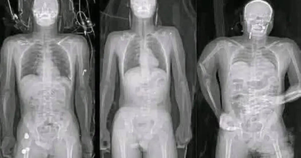 COVID 19 vaccinated individuals may be ill...