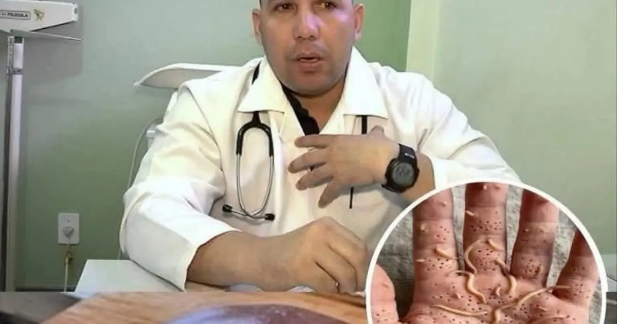 Doctors reveal that eating beef liv.er can cause...See more