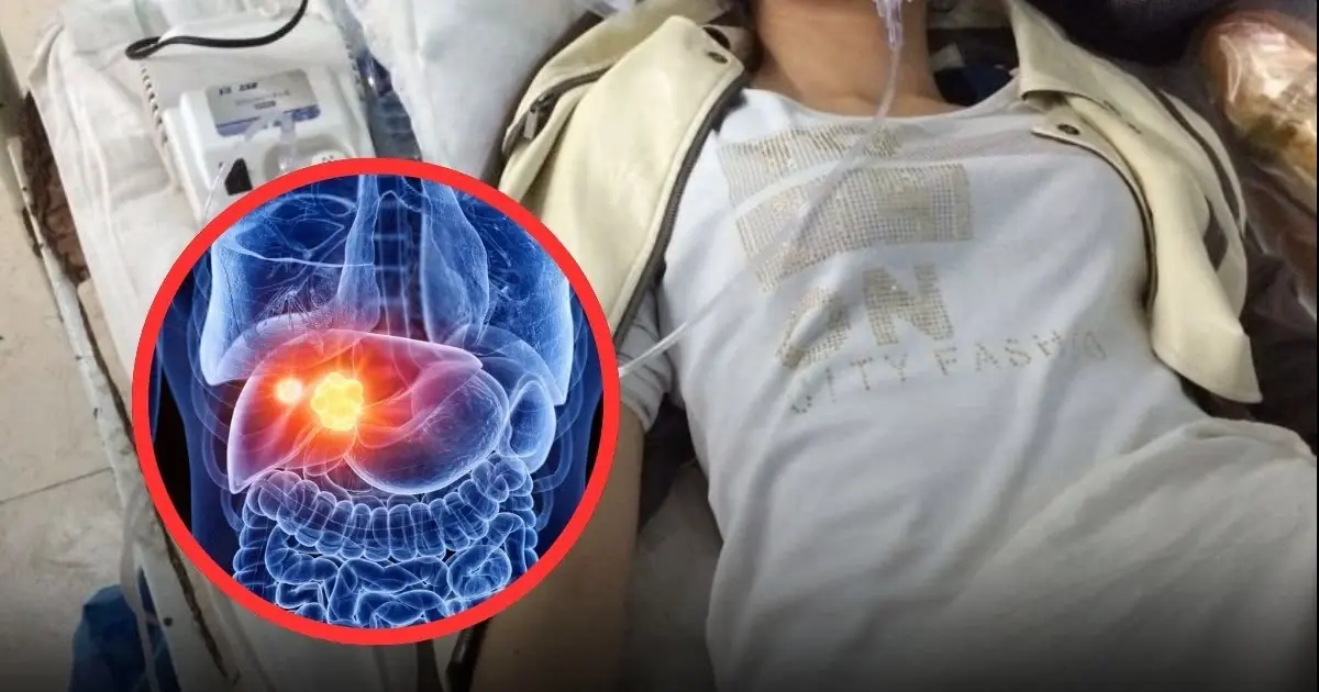 32-Year-Old Woman Lived a “Healthy” Lifestyle but Developed Li.ver Can.cer—Doctors Warn: This Vegetable Is Safe in Small Amounts but To.xic in Excess