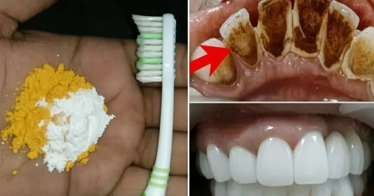 Home Teeth Whitening: Get Whiter Teeth in Just 2 Minutes!