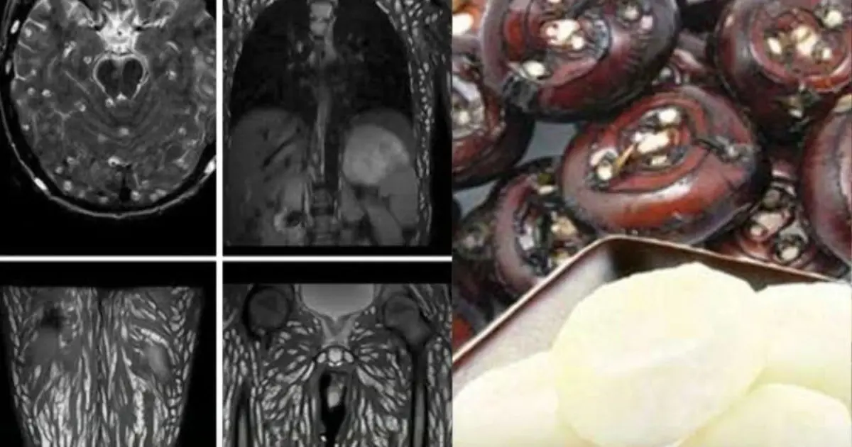 Eating Just One Bite is Already Harmful, But Many Still Eat It Without Worry