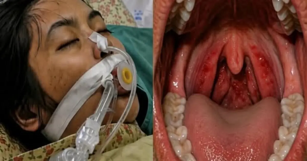 Article Title: Sore Throat Warning Signs: When a Common Symptom May Become an Emergency