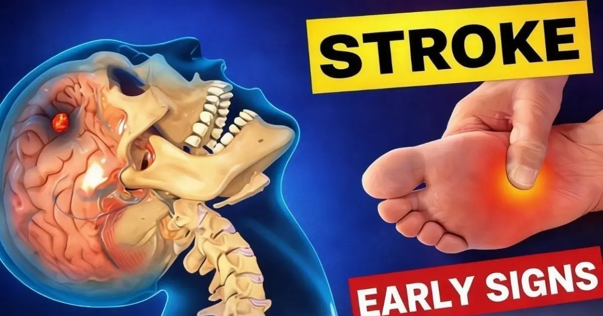 8 Warning Signs of Stroke That May Appear One Month Before — and 9 Ways to Help Reduce Your Risk