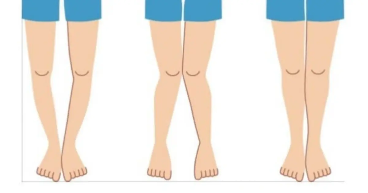 The Surprising Connection Between Your Legs and Va.gi.nal Health: What Women Should Know