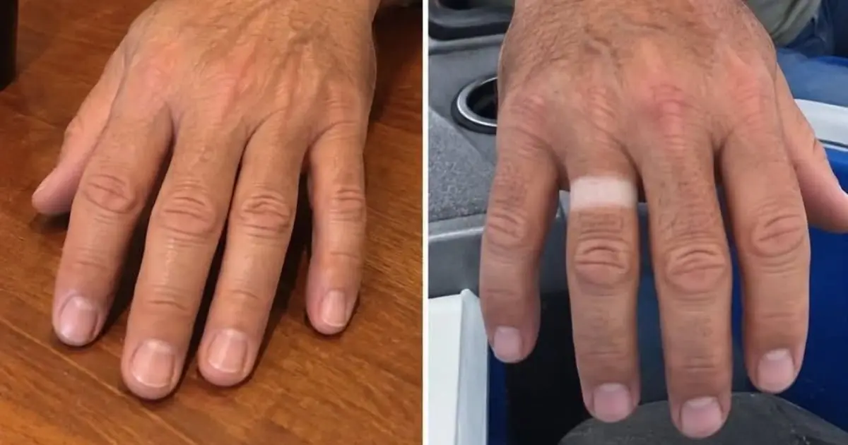 My Husband Came Home From a Fishing Trip With a Strange Ring Mark on His Finger - Then He Explained Why