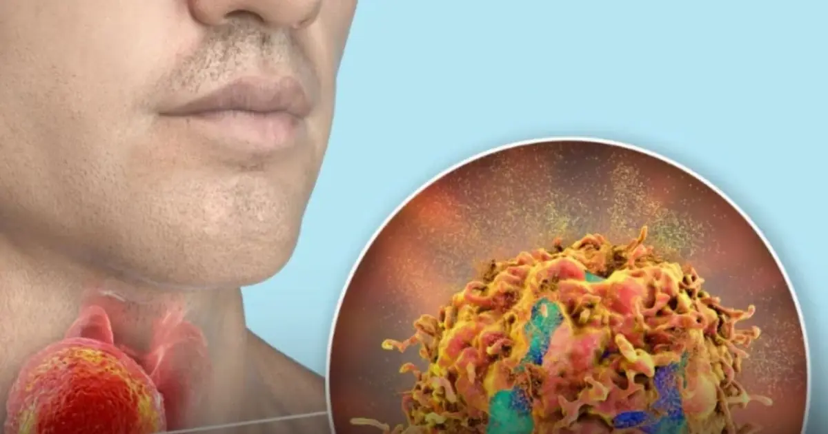 Why You Keep Feeling Mucus in Your Throat — And What Could Be Causing It