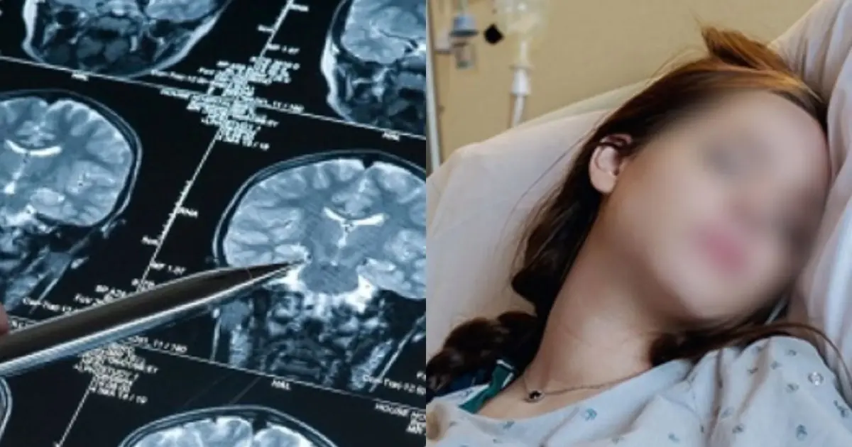 5 Alarming Stroke Warning Signs to Watch for in Young People