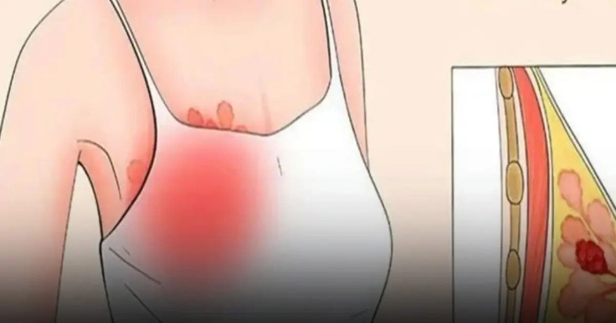 Your Body May Be Sending Early Breast Cancer Signals — Here’s What to Look For