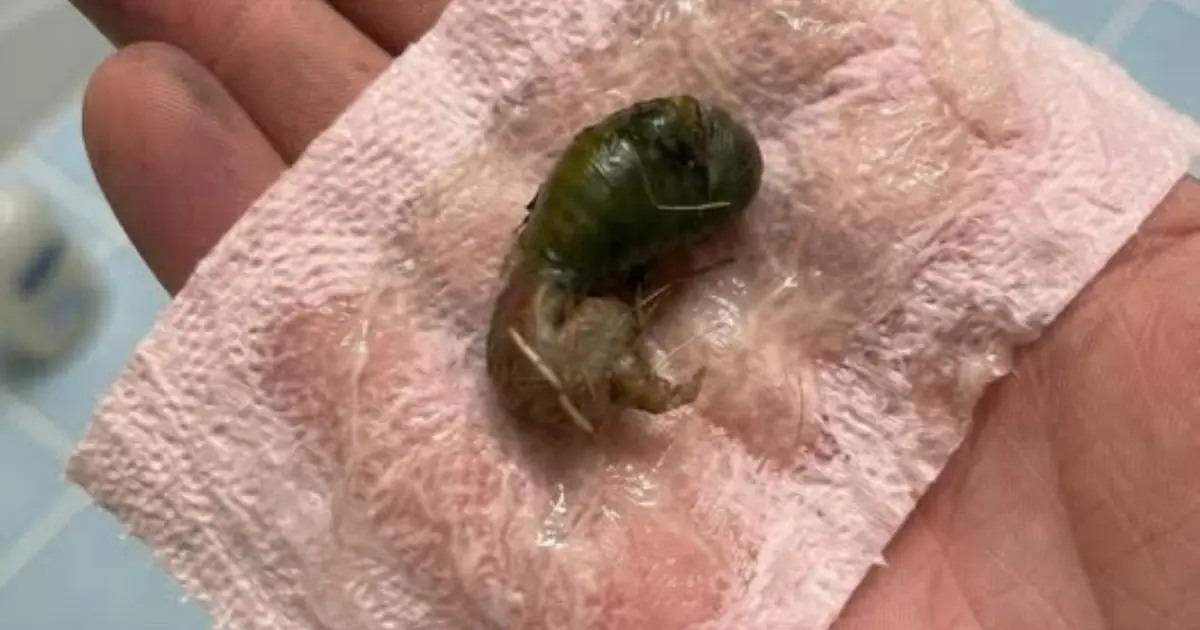 What is this?