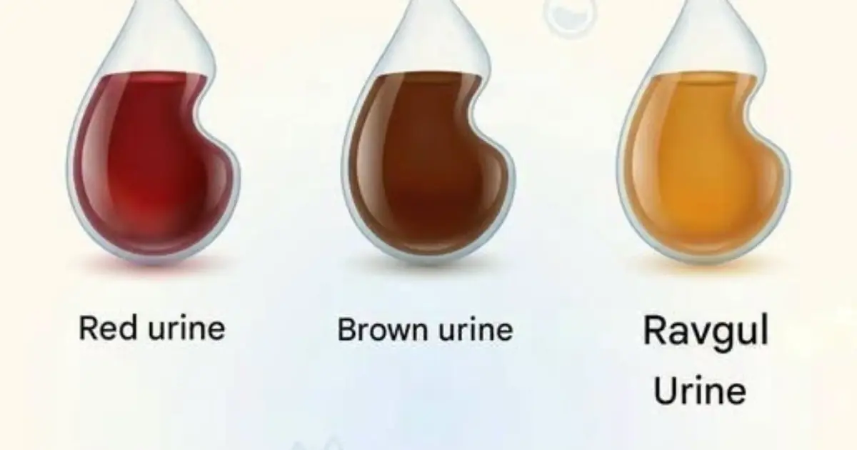 What the Color of Your Urine Can Tell You
