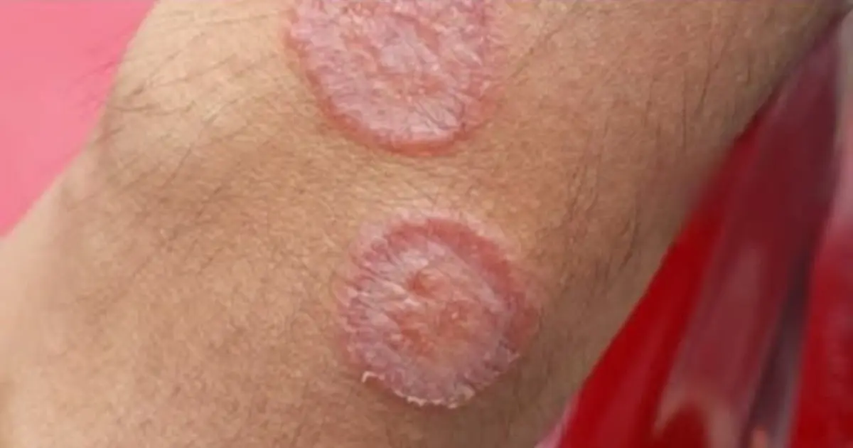 These are the signs that he is cr… See more