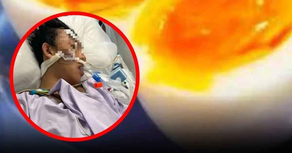 Man Dies After Eating Eggs? The Truth About Egg Safety and Dangerous Eating Habits