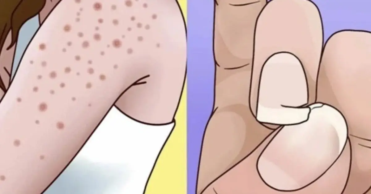 Gluten: 9 little-known symptoms that should alert you