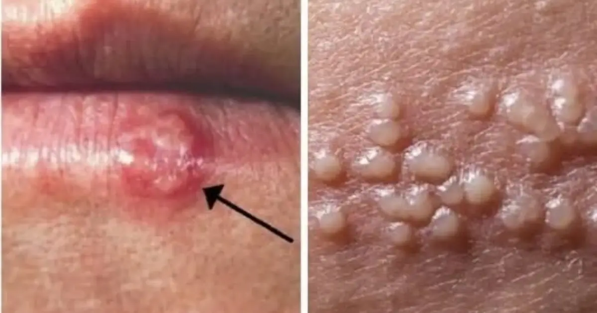 10 Subtle Warning Signs Your Body May Be Sending You (And Why You Shouldn’t Ignore Them)