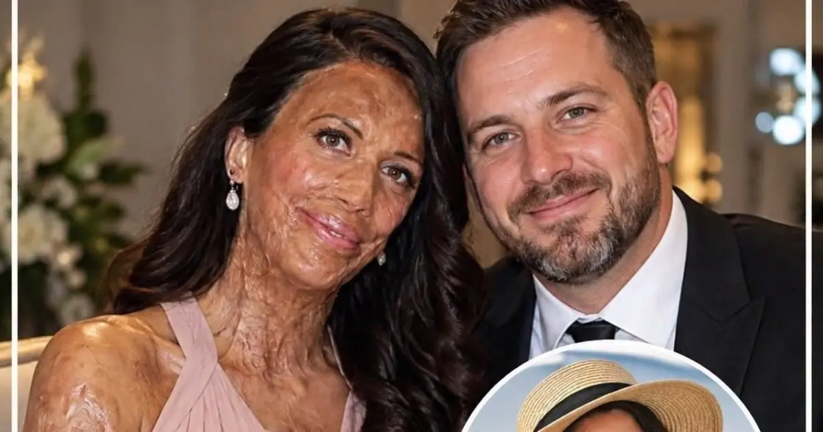 Their love survived the unimaginable - discover the powerful story behind Turia Pitt and Michael Hoskin