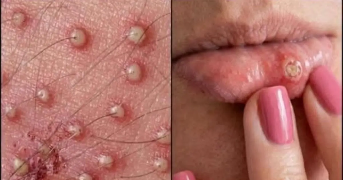 Attention! These are the first signs of this…See more