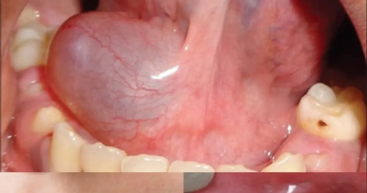These May Be the First Signs of a Mouth Condition: 7 Oral Symptoms You Should Never Ignore